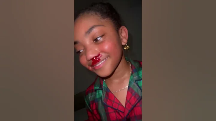 Lani Love Got a Nose Bleed #shorts #lanilove #nosebleed - DayDayNews