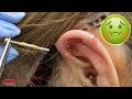 IS HER EAR PIERCING INFECTED!?