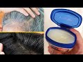 Gray Hair Turn To Black Hair Naturally Permanently with Vaseline |White hair to black hair naturally