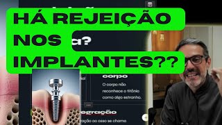 O Segredo por Trás da Perda de Implantes Dentários! Existe mesmo a Rejeição?