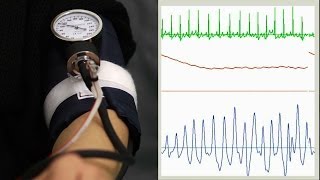 Oscillometric blood pressure measurement