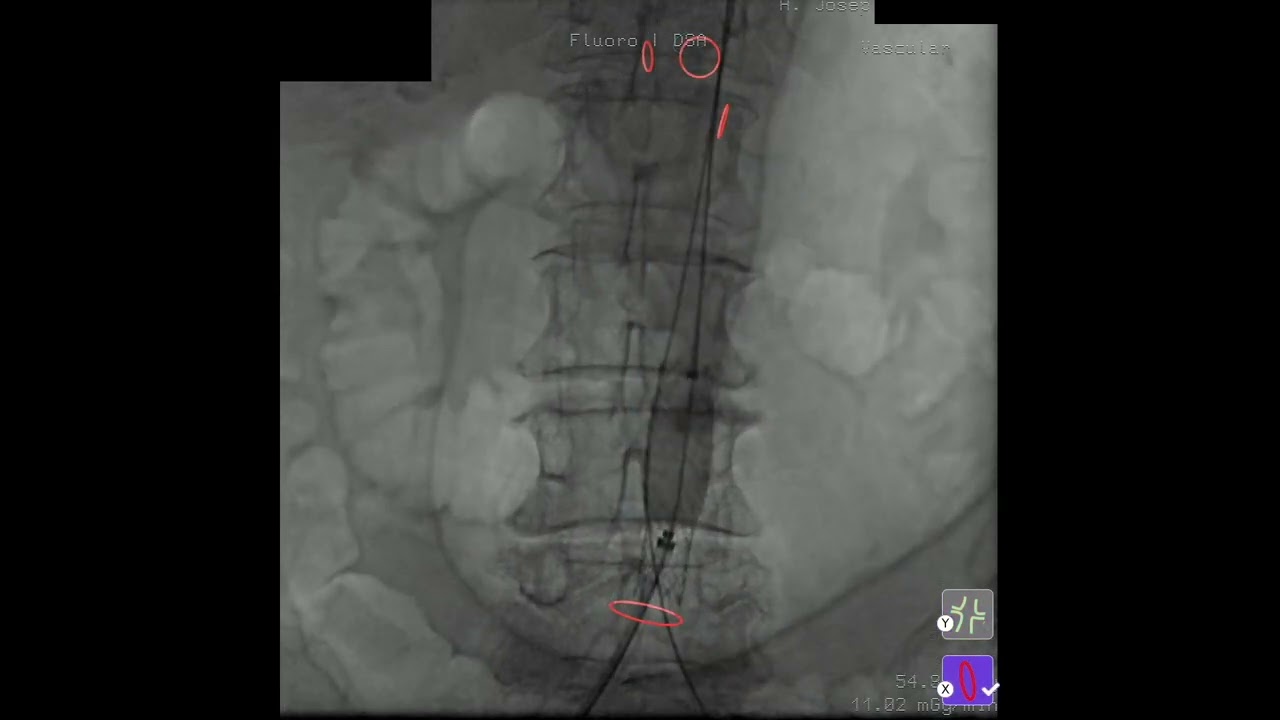 VID 9  CERAB TECHNIQUE