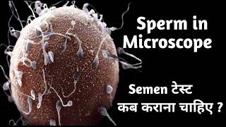 Real Sperm Cells Under Microscope Revealed II Semen