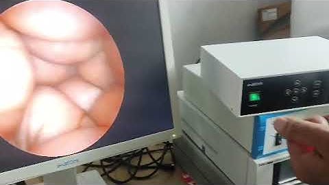 ENT OPERATIVE ENDOSCOPY CAMERA WITH PORTABLE LED LIGHT SOURCE