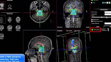 nordicBrainEx v2.1 How to create fiber groups for export