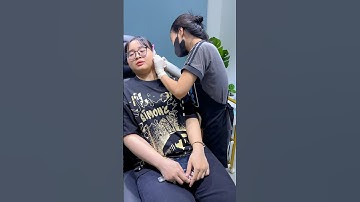 Tại sao kiêng ăn nhưng vẫn bị sẹo lồi sau khi xỏ khuyên? #tinybox #piercing