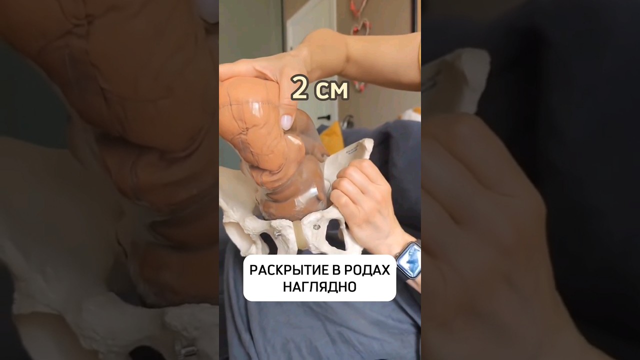 Раскрытие шейки в родах