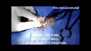 Emergency Tracheostomy | Explained Step by Step | Animated | SMS HOSPITAL JAIPUR screenshot 1