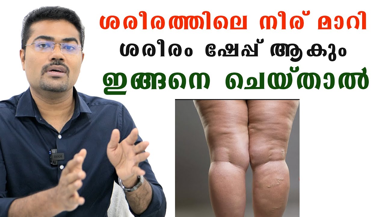 ശരീരത്തിലെ എല്ലാത്തരം നീറുകളും വറ്റിപ്പോകും ,ശരീരം ഷേപ്പ് ആകും ഇങ്ങനെ ചെയ്താൽ /Dr Manoj Johnson