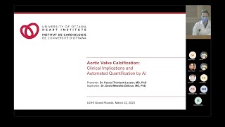 Aortic Valve Calcification: Clinical Implications and Automated Quantification by AI screenshot 5