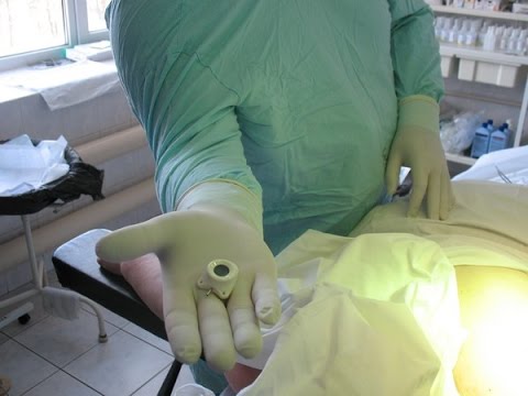 Порт-системы для венозного доступа. Паллиативная помощь онкологическим больным.