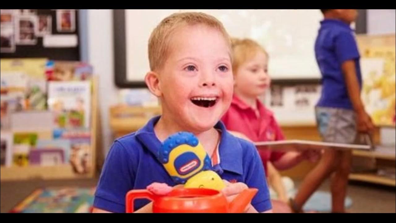 Синдром дауна игрушки