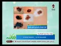 جمالك   أنواع الوحمات و أسبابها و طرق علاجه مع مراكز نبض حالتي