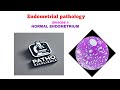 Silent Focus Learning: Endometrium Basics | No Music | EP1