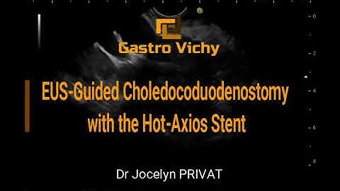 EUS-guided Choledocoduodenostomy with the Axios™ stent