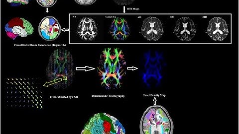 MRI Physics of Diffusion Weighted Imaging Part 22