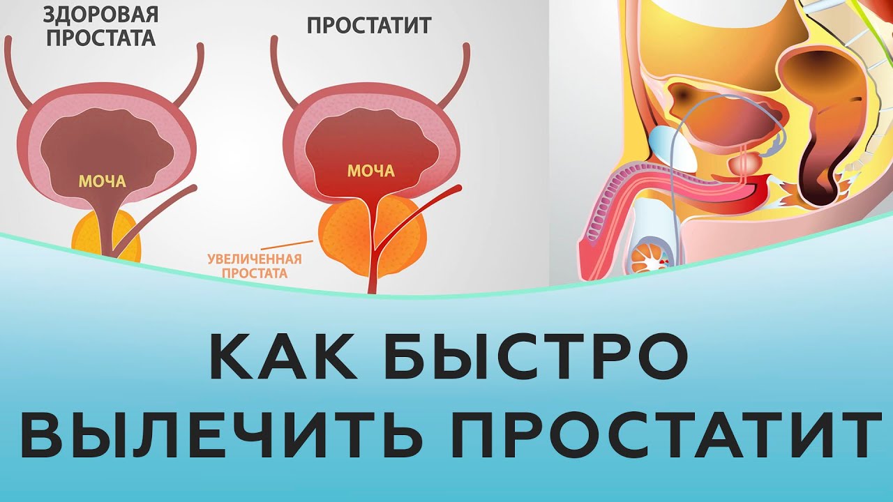 фото таблеток от простатита