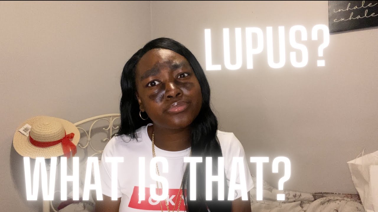 My First Video! Storytime: Being Diagnosed With Lupus😬
