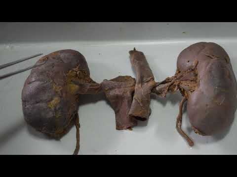 Dissection - Anatomy of Kidney