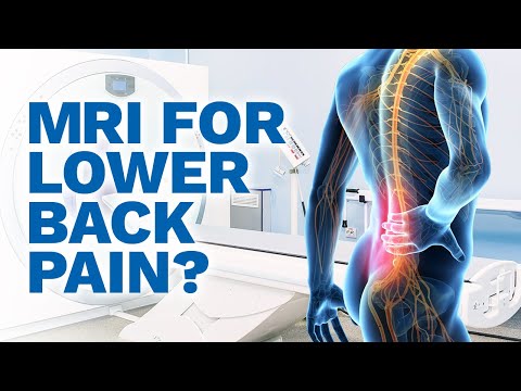 Do I need an MRI for lower back pain?  True or False