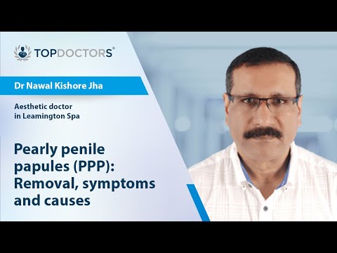 Pearly penile papules (PPP): Removal, symptoms and causes - Online interview