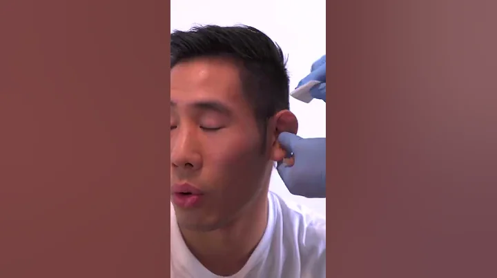 When your Friend Drains your Cauliflower Ear