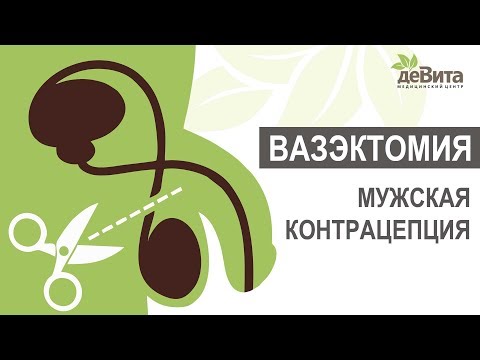 Вазэктомия — мужская хирургическая контрацепция