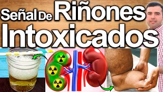 ALERTA! RIÑONES INTOXICADOS - Signos Y Síntomas Que Indican Riñones Enfermos