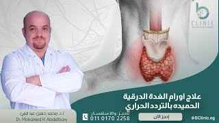 علاج عقد الغدة الدرقية الحميدة بالتردد الحراري