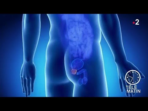 Vidéo: Pourquoi la prostate grossit-elle ?