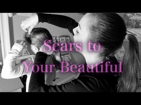 Alessia Cara - Scars To Your Beautiful (Cover by Lillian Rinaldo)