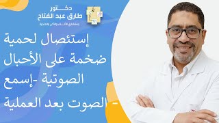 إستئصال لحمية ضخمة على الأحبال الصوتية (إسمع الصوت بعد العملية )