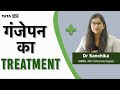 गंजापन (Baldness) कैसे दूर करे? Dr. Sanchika | Hair Fall treatment