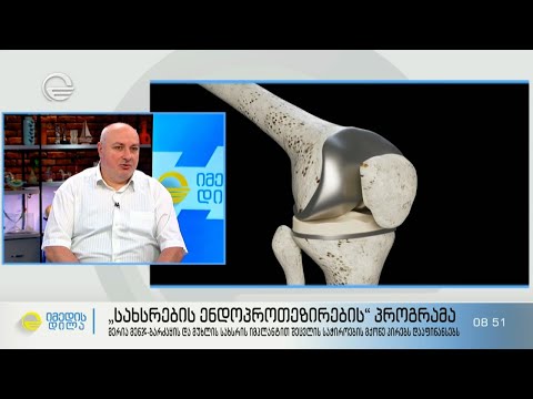 „სახსრების ენდოპროთეზირების“ პროგრამა მენჯ-ბარძაყის და მუხლის იმპლანტს დააფინანსებს