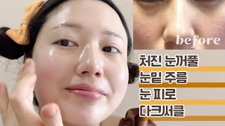 🌏CC) 탄력있는 눈꺼풀, 눈밑, 미간, 전택궁, 눈가 마사지,  eyelid & under eyes massage