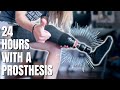 My FIRST 24 Hours With a PROSTHETIC Leg!🦵