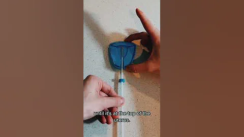 IUD Insertion & IUD Removal (Copper Paragard, Mirena) (Part 2)