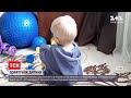У Львові трирічний хлопчик проковтнув іграшкові магніти, які продірявили кишківник