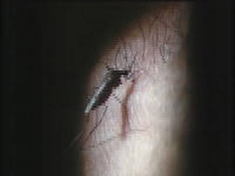 Video: Midlertidig Og Mikromatisk Heterogenitet I Fordelingen Af Anopheles-vektorer Af Malaria Langs Den Kenyanske Kyst