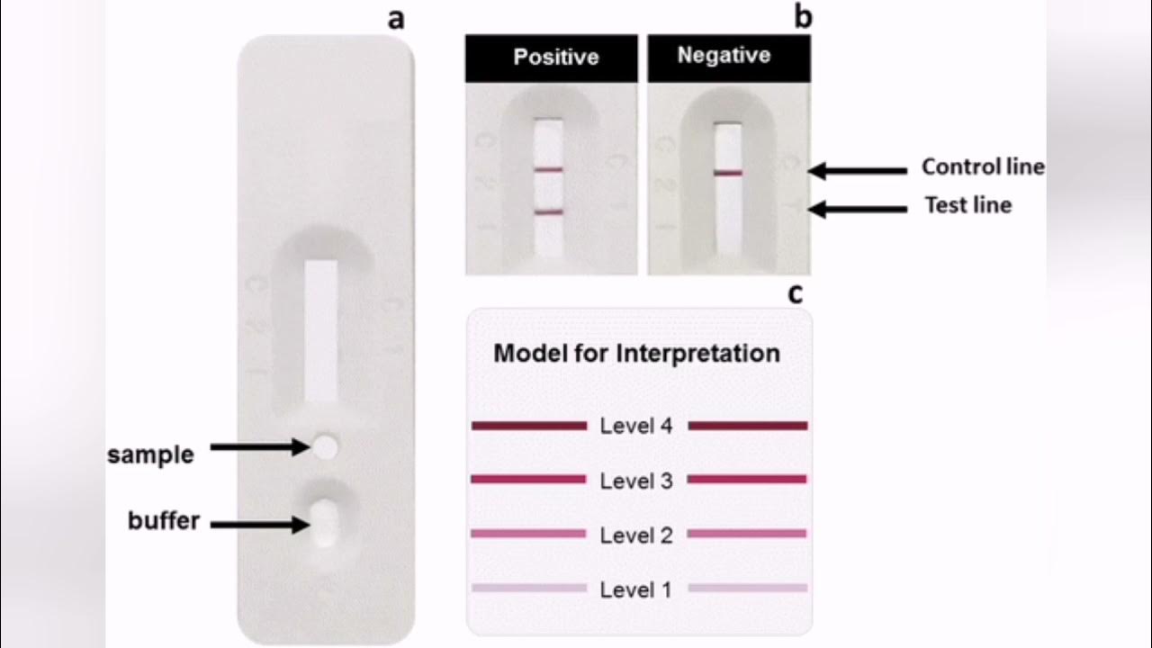ICT for HIV, HbsAg, HCV in medical ward YouTube