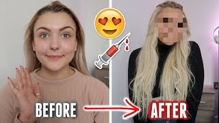 The ULTIMATE Glow Up Transformation Video *i got LOTS of filler*