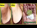 Whiten Dark Underarms Naturally Permanently | 100% Works At Home