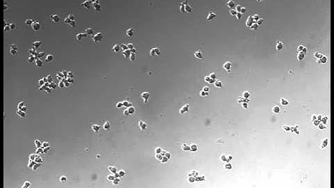 Time-lapse microscopy - no microgrid array