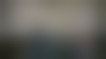 Laparoscopic Hysterectomy Explained by Dr. Sampath Gnanarathne