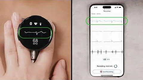 How to Capture an ECG (electrocardiogram) with the Eko CORE 500™ Digital Stethoscope