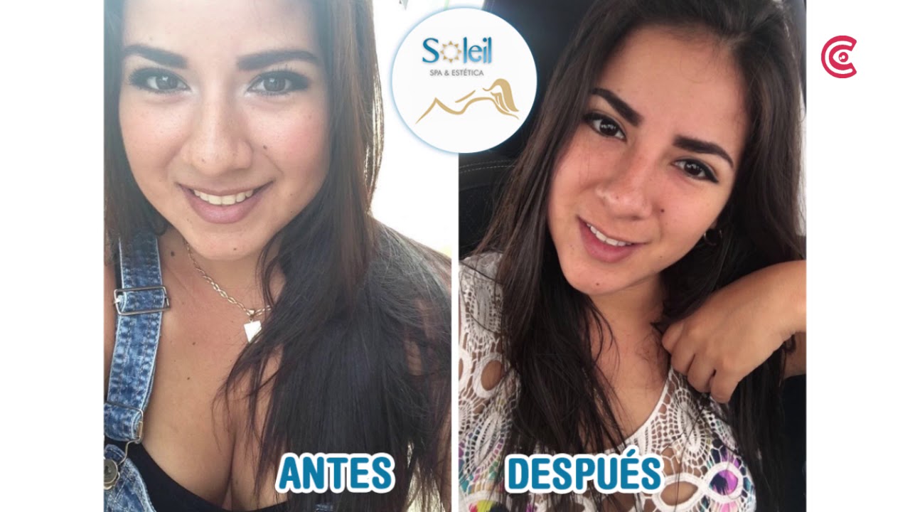 propiedades de la vitamina c endovenosa