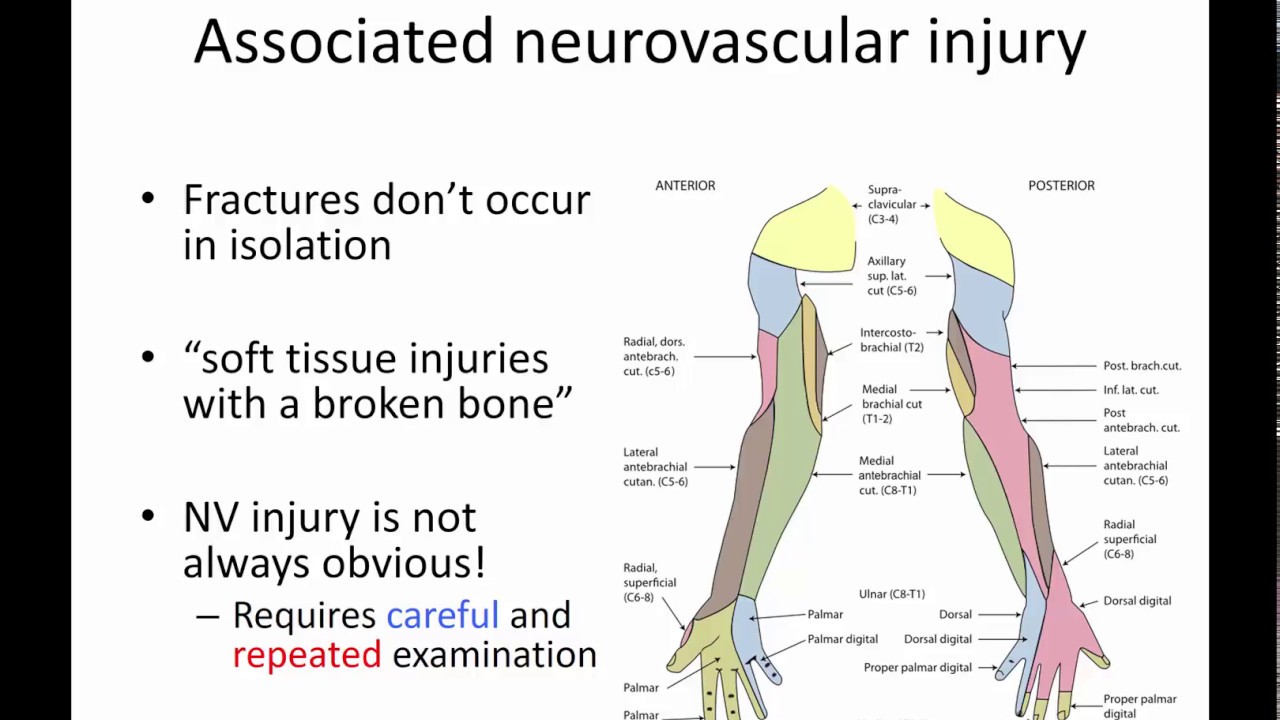 General principles of ortho trauma for PA students 4 associated