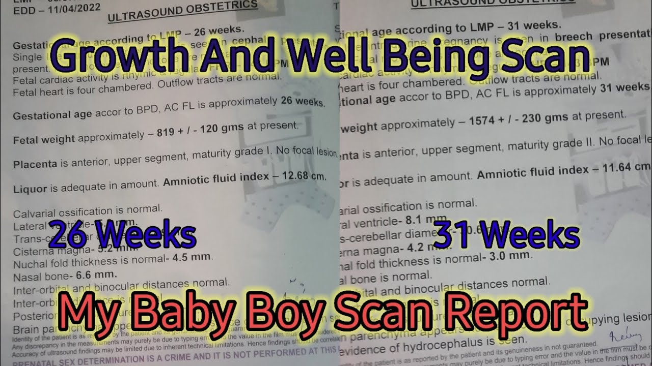 My Baby Boy Growth And Well Being Scan 7th And 9th Month Scan 26 31 my-baby-boy-growth-and-well-being-scan-7th-and-9th-month-scan-26-31