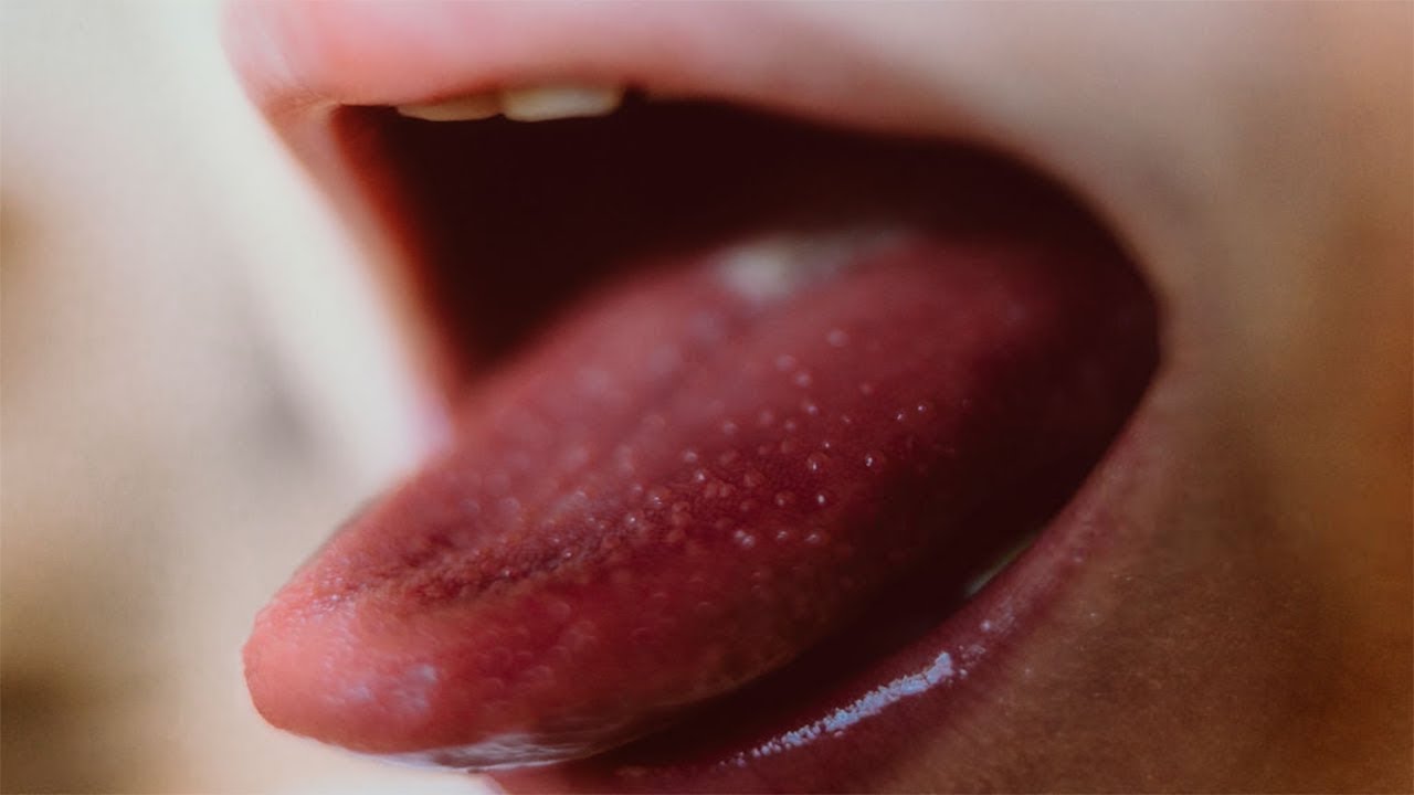 hiv stories philippines 10 Common HIV Symptoms In Women That You Shouldn't Ignore