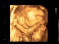 3D/4D УЗИ 21 неделя (3D/4D Ultrasound scan baby 21 Weeks)